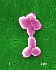 acinetobacter baumannii electron micrograph 